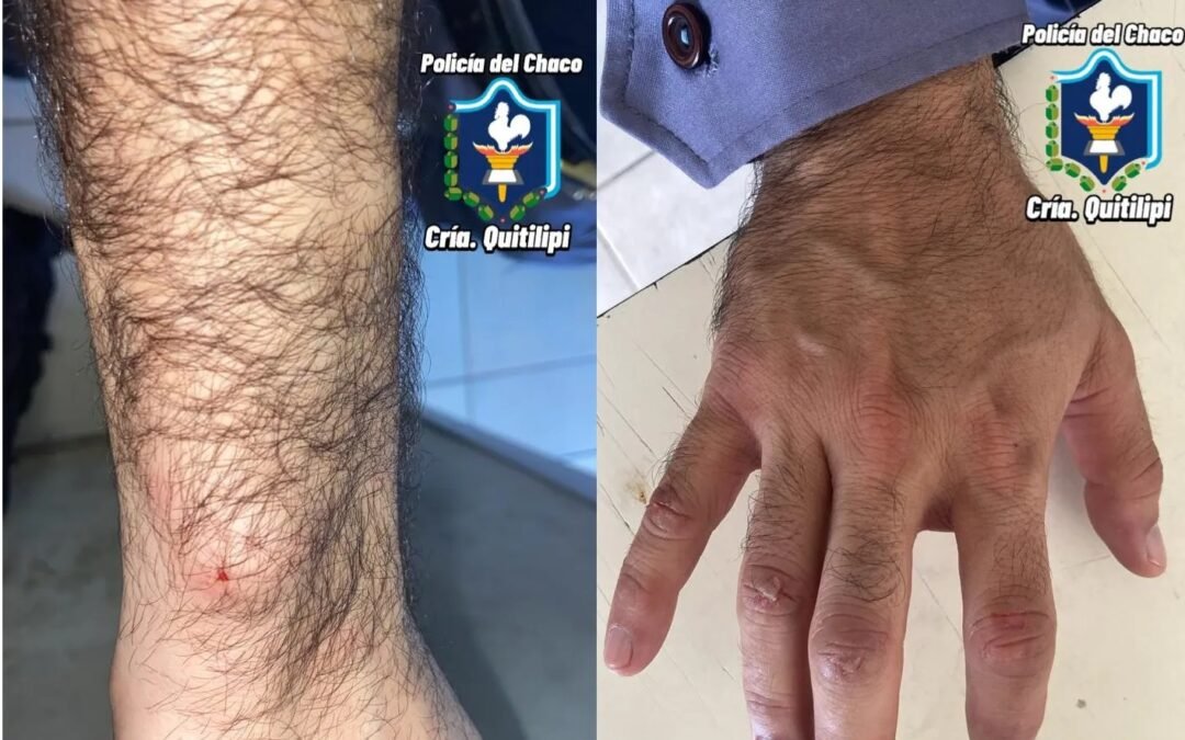Tensión en la Comisaría de Quitilipi: preso se autolesionó y atacó a dos efectivos